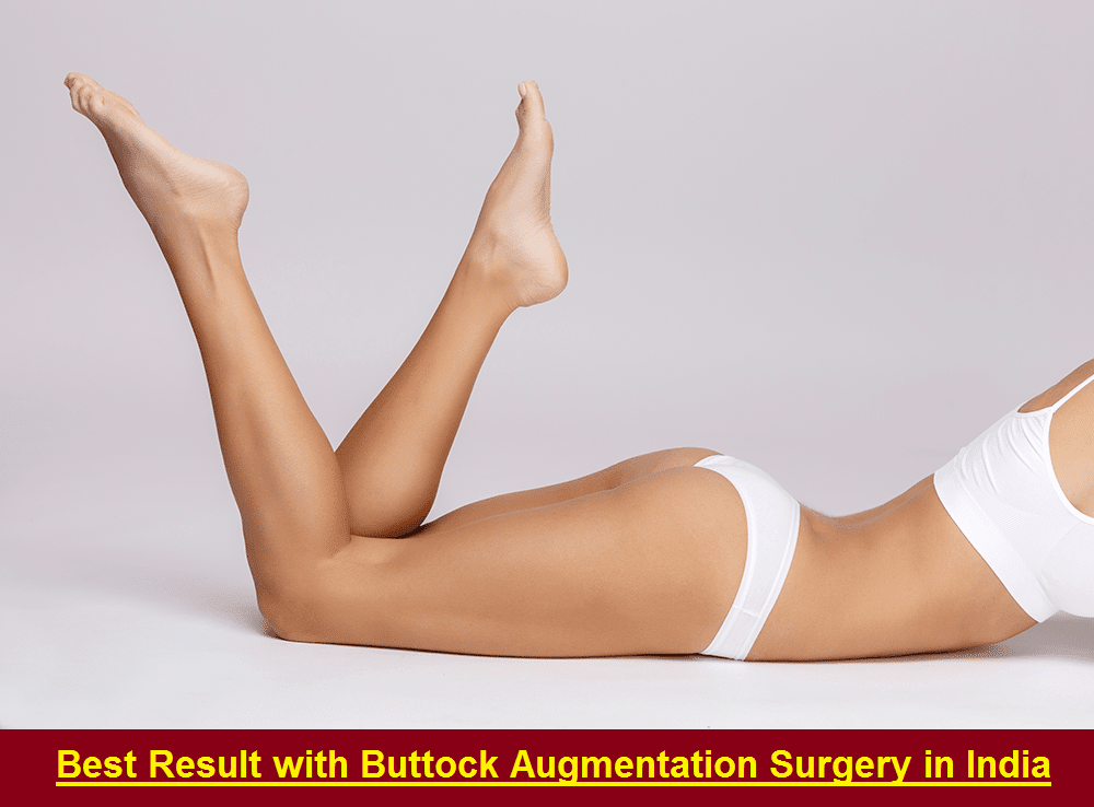 buttock augmentation