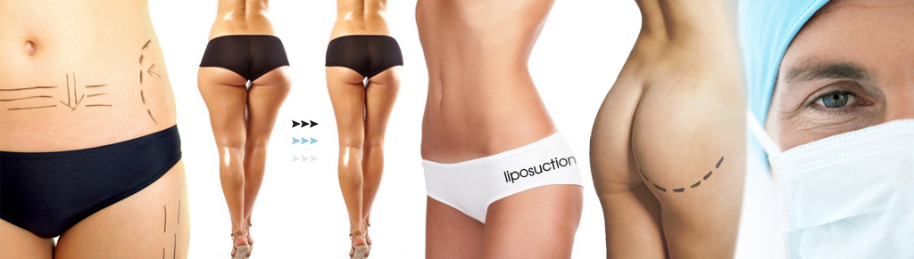 vaser-liposuction-india