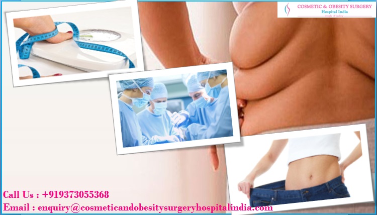 bariatric surgery in india