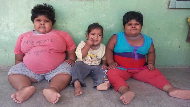 Obese kids from Gujarat