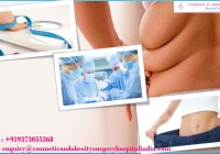 bariatric surgery in india