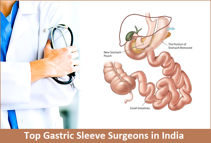 Gastric Sleeve Surgeons in India