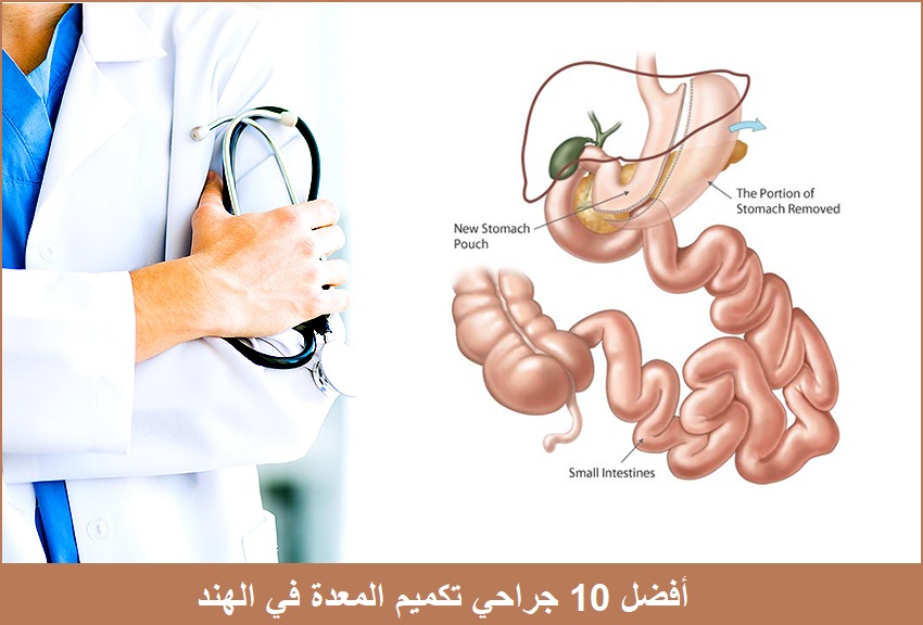 جراحو تكميم المعدة في الهند