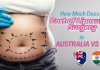 How Much Does it cost of Liposuction Surgery in Australia vs India