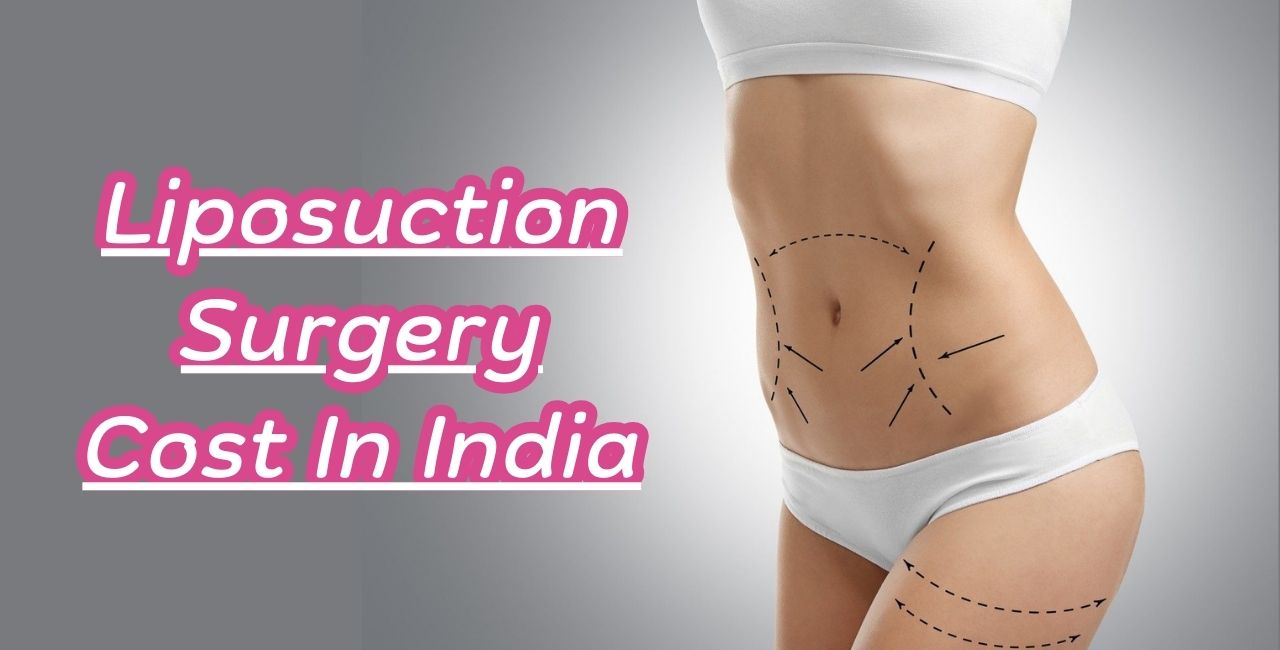Liposuction Surgery Cost In India
