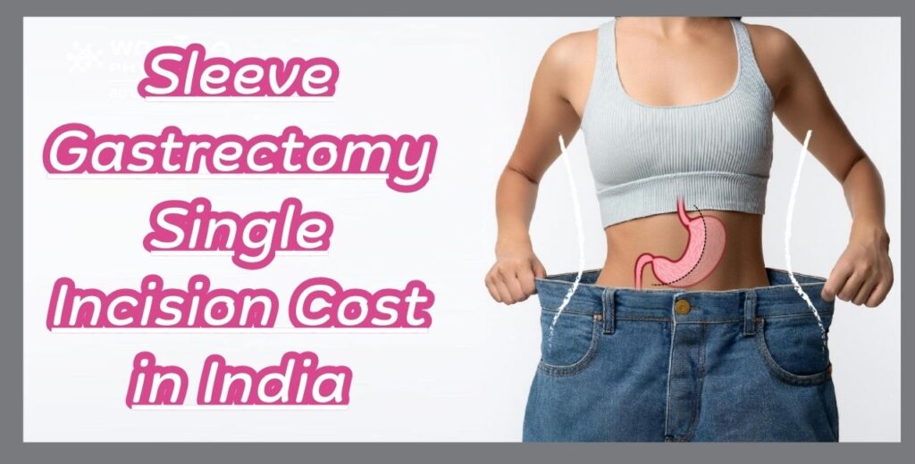 Sleeve Gastrectomy Single Incision Cost in India
