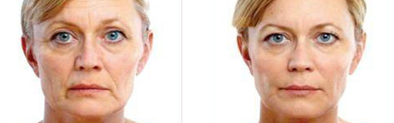 Corrective Cosmetic Surgery