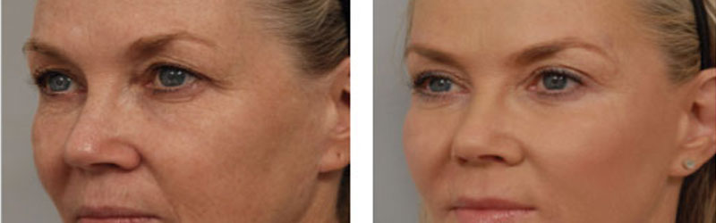 Corrective Cosmetic Surgery