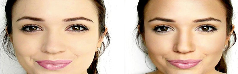 Facial Sculpting Before and After