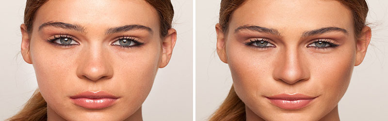 Facial Sculpting Before and After