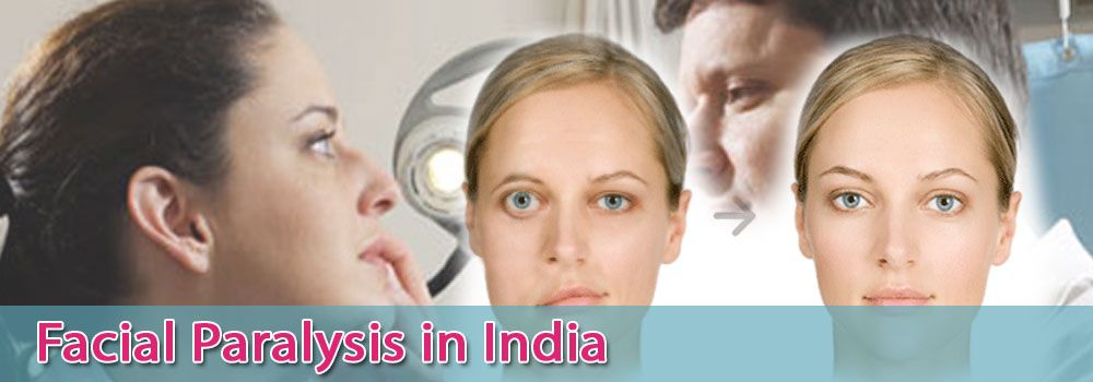 Low Cost Facial Paralysis Surgery in India