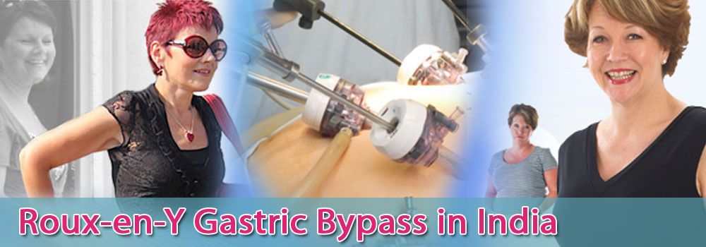 Low Cost Roux-en-Y Gastric Bypass in India