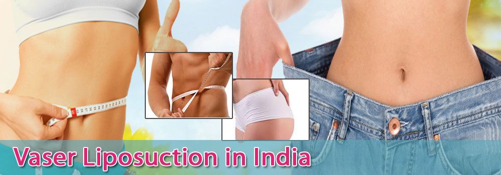 Low Cost Vaser Liposuction in India