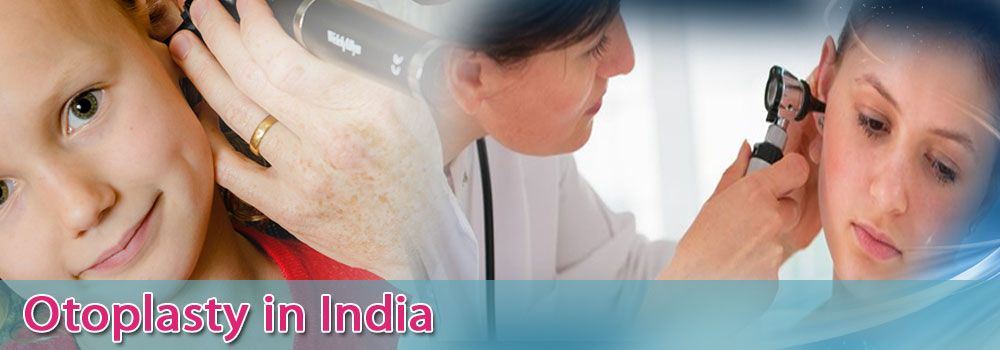 Otoplasty in India at Affordable Prices