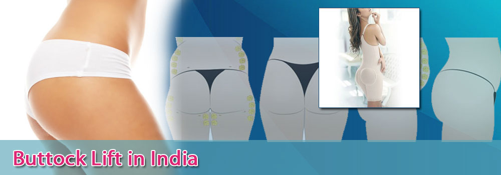 Buttock Lift in India at Affordable Prices