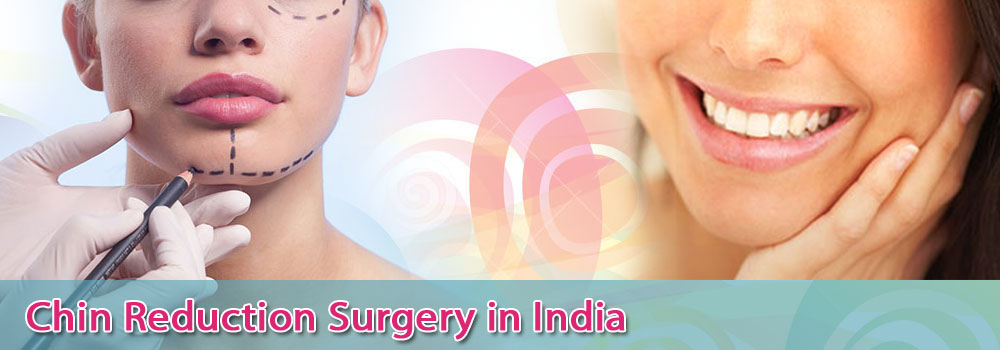 Low Cost Chin Reduction Surgery in India