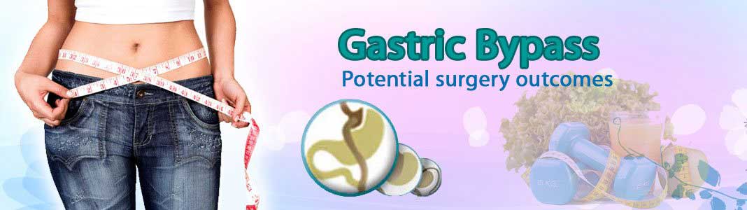 Gastric Bypass Surgery in India