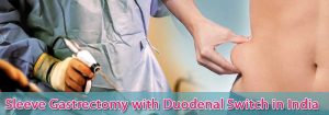 Sleeve Gastrectomy surgery in india