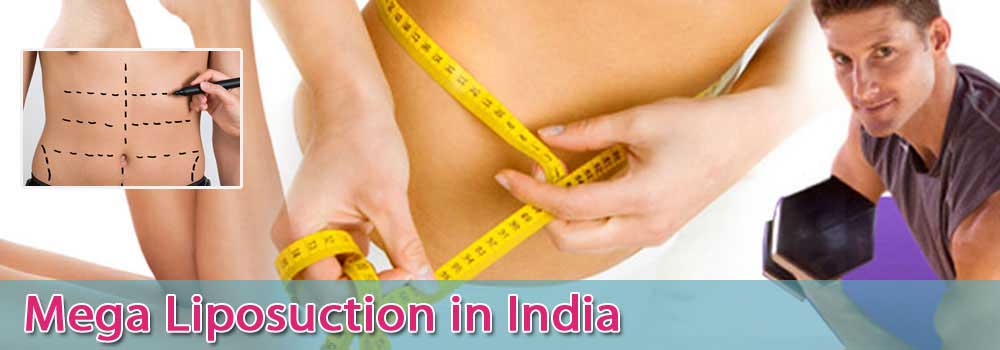 Mega Liposuction In India At Affordable Price