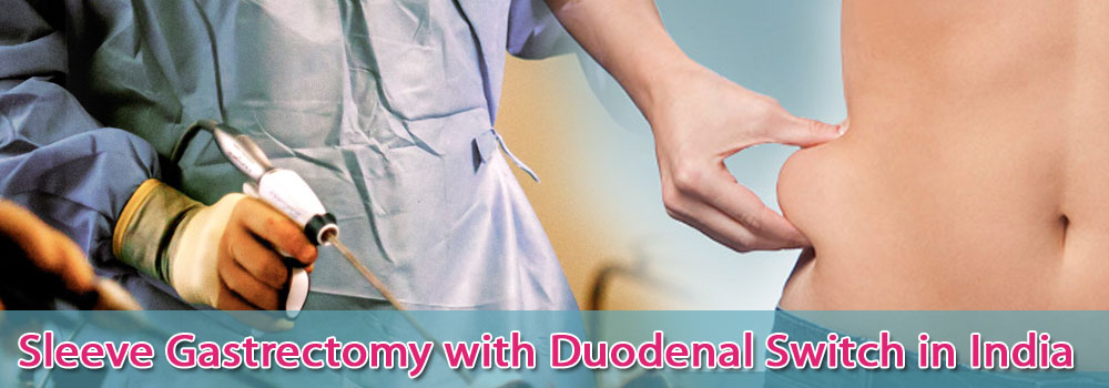 Sleeve Gastrectomy Duodenal Switch Surgery India