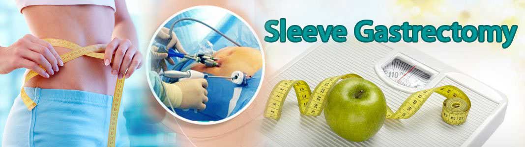 Sleeve Gastrectomy Surgery in India