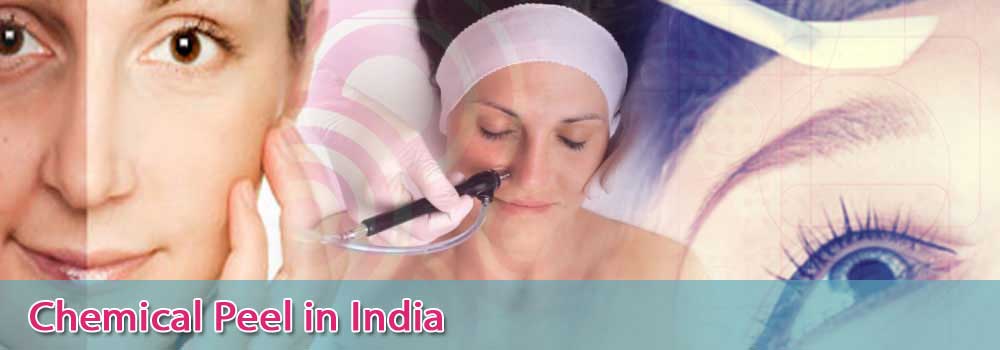Low Cost Chemical Peel In India