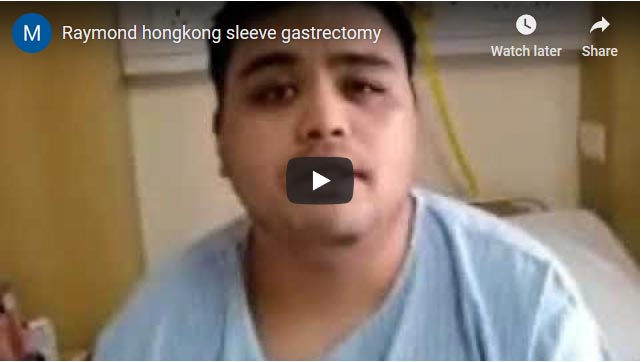 Sleeve Gastrectomy Surgery India